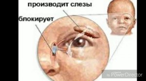Наш опыт зондирования слёзного канала 2018 год Алматы КазНИИ Глазных болезней