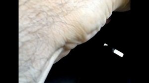 Ремонт крепления бампера.