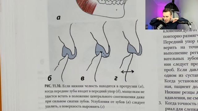 11. Функциональная окклюзия. Питер Доусон