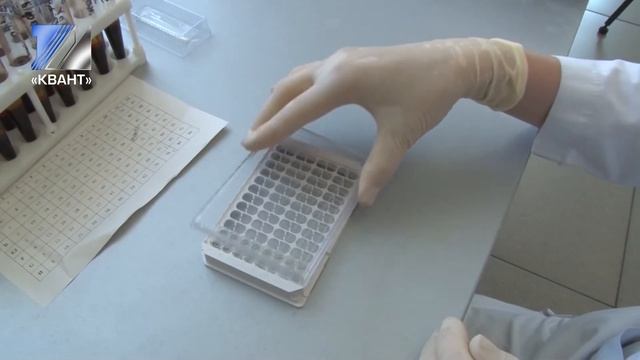 В Междреченске зафиксирован рост заболевших ВИЧ-инфекцией смотреть онлайн