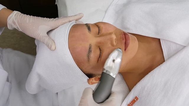 RF Microneedle FLORA CEL смотреть онлайн