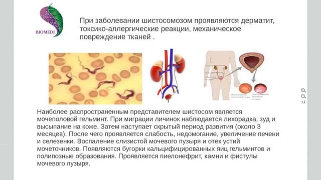 ***Паразит Шистосома***|***Parazit Shistosoma***