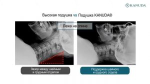 Реклама подушки Kanuda