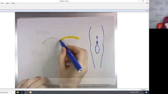 Основные эхографические паттерны Коленный сустав смотреть онлайн