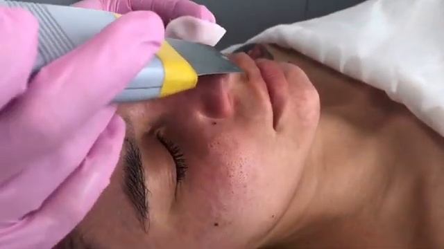 Чистка лица у косметолога