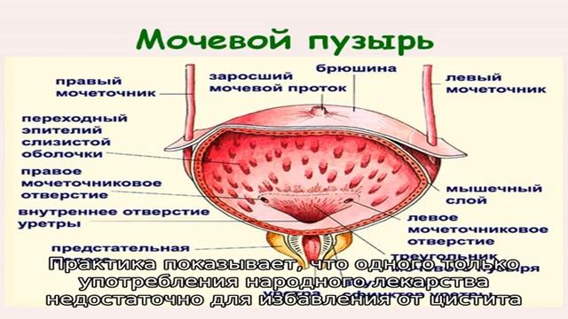 Эпицистома мочевого пузыря. Лучевой цистит симптомы. Монурал от мочевого пузыря.