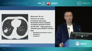 Бронхоскопия при периферических образованиях легких - от навигации до ультразвука