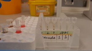 Прямая проба Кумбса (DAT). Практика.