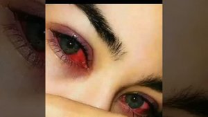 ~Песня~Почему мне так больно мама так больно~🥀~2022~