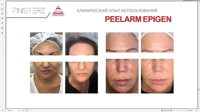 Вебинар для профессионалов Finistere + STYX смотреть онлайн