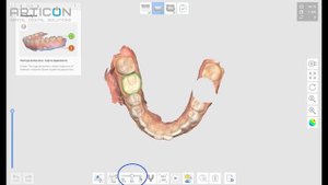 КОФФЕРДАМ: НУЖНО ЛИ ОТКАЗЫВАТЬСЯ ПРИ СКАНИРОВАНИИ? | ЛАЙФХАКИ В ЦИФРОВОЙ СТОМАТОЛОГИИ | ARTICON