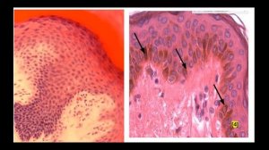 Гистологическое строение кожи. Толстая кожа. Препарат: кожа пальца человека (г-э).