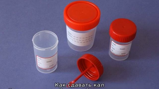 Как собрать кал у грудничка на анализ — сколько нужно на копрограмму