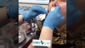 Мазок и соскоб слизистой