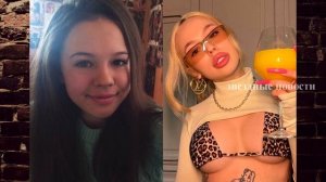 ШОК!!!! Какой была Инстасамка до пластики.