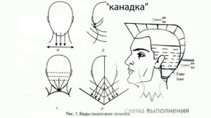 Мужская Прическа Полька