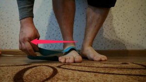 Упражнения при плоскостопии