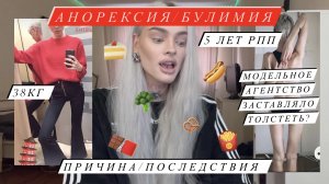 5 ЛЕТ РПП! Моя история: анорексия, булимия