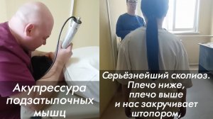 Искривления тела человека буквально за 5 мин уходят! Акупрессура подзатылочных мышц подробно. Отзыв