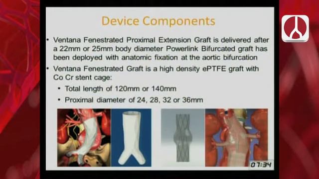 Estado actual de las Endoprótesis Fenestradas - Dr. Alejandro Fabiani смотреть онлайн