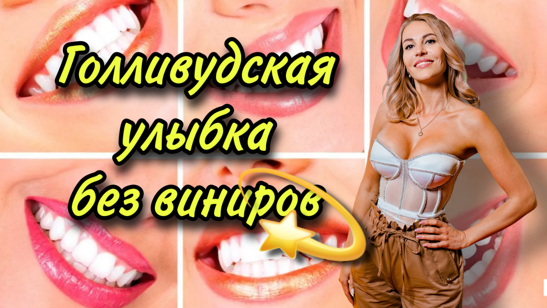 Голливудская улыбка без виниров