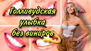 Голливудская улыбка без виниров
