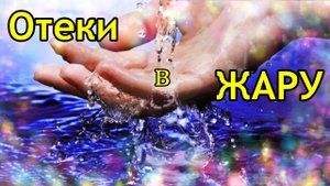 Что делать если отекают ноги?
Как помочь себе при отеках ног летом?