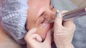 Камуфляж кругов под глазами