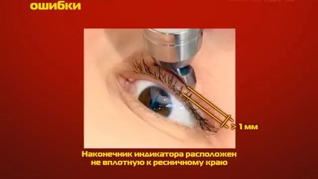 Измерение внутриглазного давления индикатором ИГД-02 смотреть онлайн