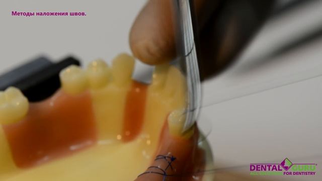 Методы наложения швов смотреть онлайн