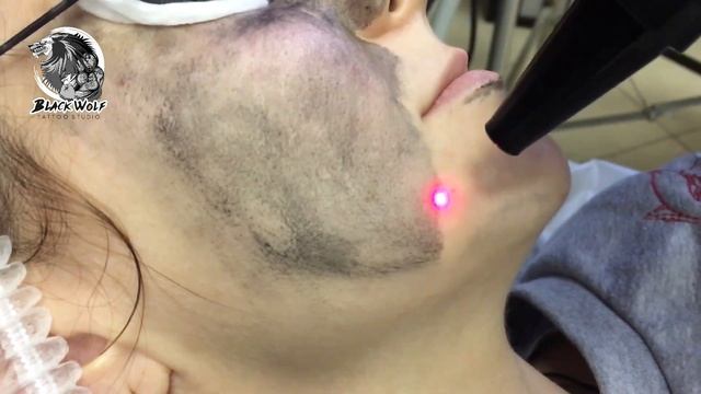 Карбоновый пилинг / Black Wolf Crew смотреть онлайн