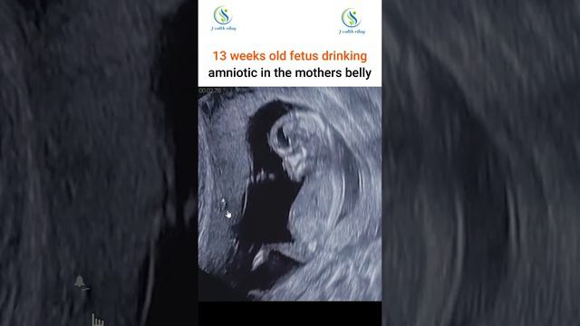 13 weeks old fetus drinking amniotic in the mothers belly  #pregnant #fetus #drink #amniotic #fluid