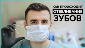 Вся правда про отбеливание зубов. Безопасно ли отбеливание для зубов. Этапы отбеливания зубов
