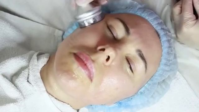 Урок. Радиочастотный лифтинг