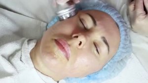 Урок. Радиочастотный лифтинг