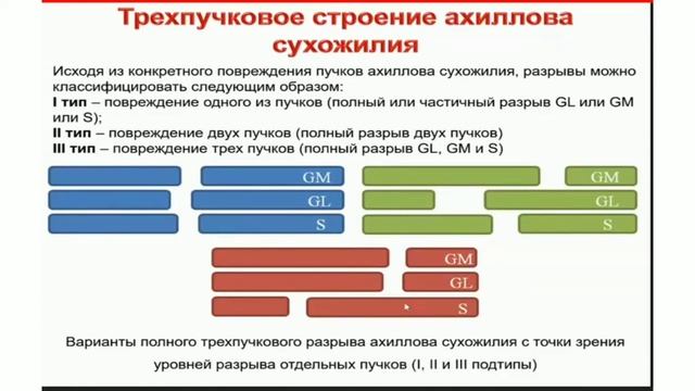 Ахиллово сухожилие смотреть онлайн