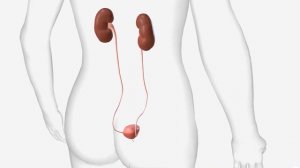 Блуждающая почка