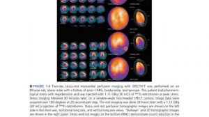 BENG280C Lecture 1 Intro to Imaging Methods