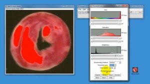 Using ImageJ to measure areas in histological samples