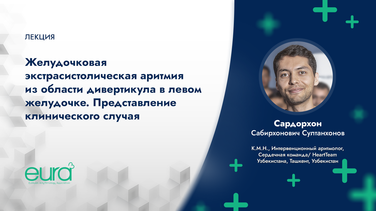 ЖЭС из области дивертикула в левом желудочке. Представление клинического случая смотреть онлайн
