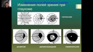 Глаукома Часть 1