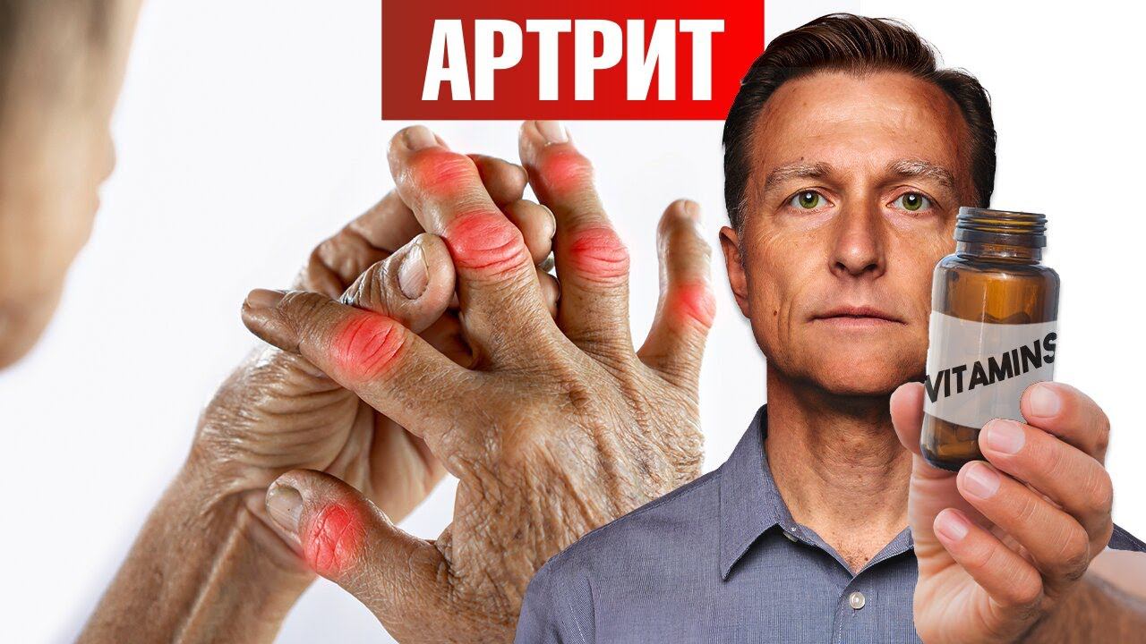 Лучший витамин от артрита (и это НЕ витамин Д)