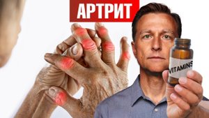 Лучший витамин от артрита (и это НЕ витамин Д)