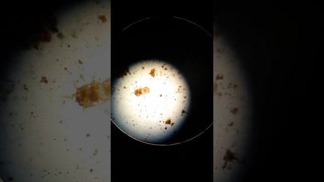 Ушные клещи (отодектоз) у кошки смотреть онлайн