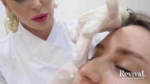 Контурная пластика\Belotero смотреть онлайн