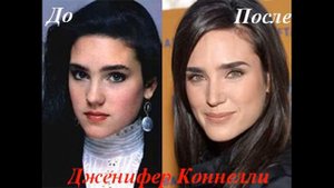 15 знаменитостей, которые сделали ринопластику. До и после. Часть 1.