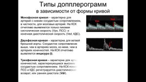 Введение в допплерографию. Часть II. Качественные параметры кровотока