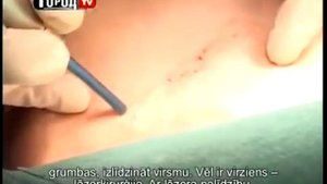 Пластическая хирургия
