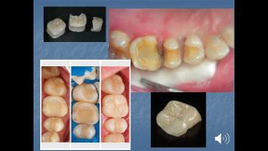 Лекция №1 для студентов 5 курса 9 семестра стоматологического факультета