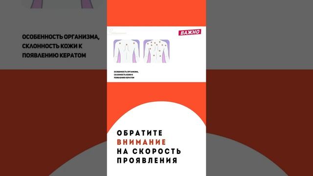 Когда стоит переживать по поводу родинок на теле смотреть онлайн